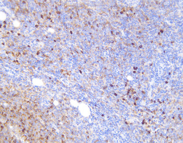 Monoklonaler Antikörper - CKM-0014 - Celnovte Biotechnology Co., Ltd. - polyklonaler Antikörper / für Forschungszwecke / Gewebe