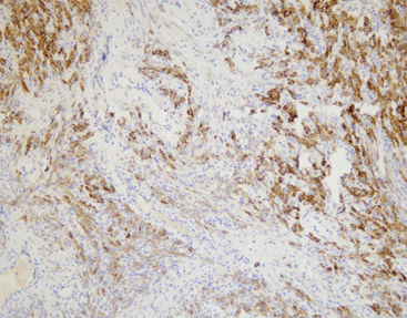 Monoklonaler Antikörper - CIM-0151 - Celnovte Biotechnology Co., Ltd. - polyklonaler Antikörper / für Forschungszwecke / Gewebe