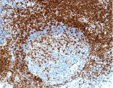 Färbelösungs-Reagenz - CCM-0354 - Celnovte Biotechnology Co., Ltd. - Farbstoff / Antigen / Gewebe