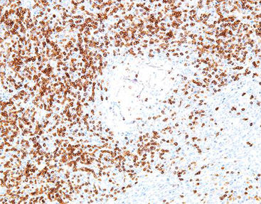 Färbelösungs-Reagenz - CCM-0372 - Celnovte Biotechnology Co., Ltd. - Farbstoff / Antigen / Gewebe