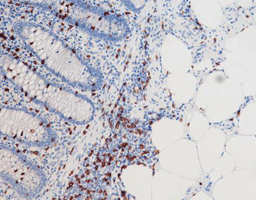 Färbelösungs-Reagenz - CCM-0374 - Celnovte Biotechnology Co., Ltd. - Antikörper / Farbstoff / Gewebe