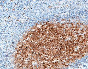Färbelösungs-Reagenz - CCM-0391 - Celnovte Biotechnology Co., Ltd. - Farbstoff / Antigen / Gewebe
