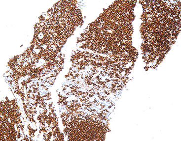 Färbelösungs-Reagenz - CCM-0461 - Celnovte Biotechnology Co., Ltd. - Farbstoff / Antigen / Gewebe