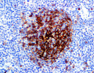 Färbelösungs-Reagenz - CCM-0483 - Celnovte Biotechnology Co., Ltd. - Antikörper / Farbstoff / Gewebe