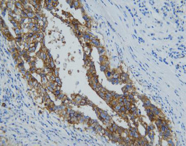 Antigen Reagenz - CCM-0523 - Celnovte Biotechnology Co., Ltd. - Färbelösung / Farbstoff / Zytokin