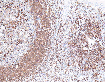 Färbelösungs-Reagenz - CCM-0734 - Celnovte Biotechnology Co., Ltd. - Antikörper / Gewebe / für Zytologie