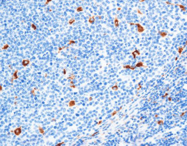 Antikörper - CCM-0701 - Celnovte Biotechnology Co., Ltd. - Färbelösung / Lysozyme / Farbstoff