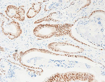 Färbelösungs-Reagenz - CCR-0822 - Celnovte Biotechnology Co., Ltd. - Antikörper / Farbstoff / Gewebe
