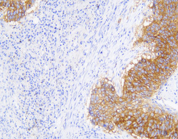 Färbelösungs-Reagenz - CEM-0033 - Celnovte Biotechnology Co., Ltd. - Farbstoff / Wachstumsfaktor / für Kliniken