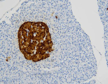 Färbelösungs-Reagenz - CCM-0852 - Celnovte Biotechnology Co., Ltd. - Antikörper / Farbstoff / Gewebe