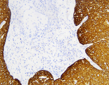 Färbelösungs-Reagenz - CCM-0983 - Celnovte Biotechnology Co., Ltd. - Antikörper / Farbstoff / für Kliniken