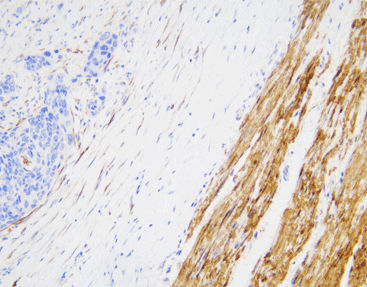 Färbelösungs-Reagenz - CCM-0213 - Celnovte Biotechnology Co., Ltd. - Antikörper / Farbstoff / Gewebe