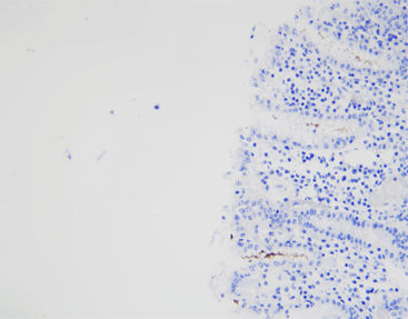 Färbelösungs-Reagenz - CHM-0173 - Celnovte Biotechnology Co., Ltd. - Antikörper / Farbstoff / Gewebe