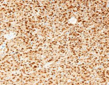 Färbelösungs-Reagenz - CIM-0200 - Celnovte Biotechnology Co., Ltd. - Antikörper / Farbstoff / Gewebe