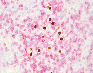 Testkit für Infektionskrankheiten - Celnovte Biotechnology Co., Ltd. - Epstein-Barr-Virus / Immunofluoreszenz / molekular