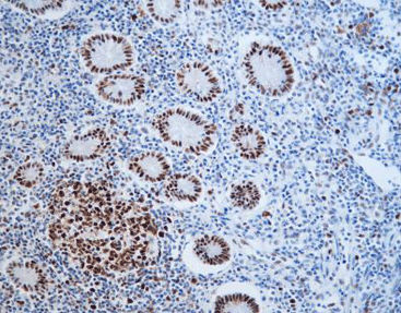 Färbelösungs-Reagenz - CMM-0202 - Celnovte Biotechnology Co., Ltd. - Antikörper / Farbstoff / Gewebe