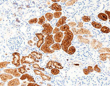 Färbelösungs-Reagenz - CNM-0012 - Celnovte Biotechnology Co., Ltd. - Antikörper / Farbstoff / für Zytologie