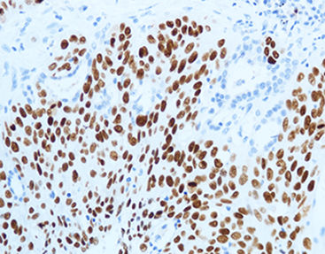 Färbelösungs-Reagenz - CPM-0133 - Celnovte Biotechnology Co., Ltd. - Antikörper / Farbstoff / Gewebe
