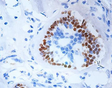 Färbelösungs-Reagenz - CPM-0160 - Celnovte Biotechnology Co., Ltd. - Antikörper / Farbstoff / für Zytologie