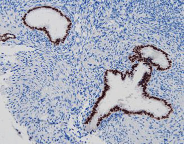 Färbelösungs-Reagenz - CPM-0252 - Celnovte Biotechnology Co., Ltd. - Antikörper / Farbstoff / Gewebe