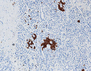 Färbelösungs-Reagenz - CSM-0250 - Celnovte Biotechnology Co., Ltd. - Antikörper / Farbstoff / Gewebe