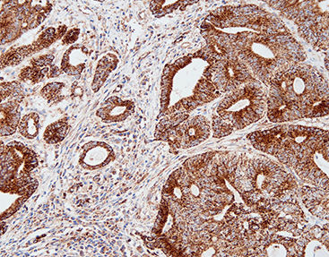 Färbelösungs-Reagenz - CSM-0230 - Celnovte Biotechnology Co., Ltd. - Antikörper / Farbstoff / Gewebe