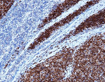 DNA-Polymerase-Reagenz - CTM-0132 - Celnovte Biotechnology Co., Ltd. - Färbelösung / Enzyme / Farbstoff