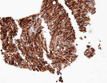 Färbelösungs-Reagenz - CTM-0213 - Celnovte Biotechnology Co., Ltd. - Antikörper / Farbstoff / Gewebe