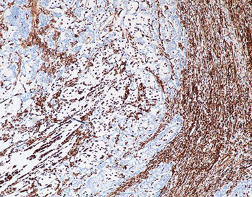 Färbelösungs-Reagenz - CVM-0040 - Celnovte Biotechnology Co., Ltd. - Antikörper / Farbstoff / Gewebe