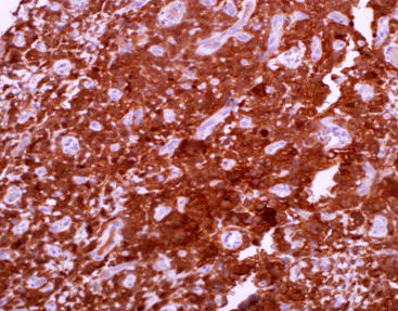 Färbelösungs-Reagenz - CAM-0160 - Celnovte Biotechnology Co., Ltd. - Antikörper / Farbstoff / Gewebe
