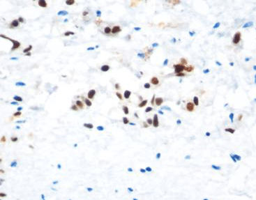 Färbelösungs-Reagenz - CAM-0211 - Celnovte Biotechnology Co., Ltd. - Antikörper / Farbstoff / für Zytologie