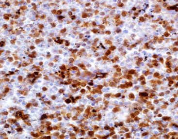 Färbelösungs-Reagenz - CAM-0220 - Celnovte Biotechnology Co., Ltd. - Antikörper / Farbstoff / Gewebe