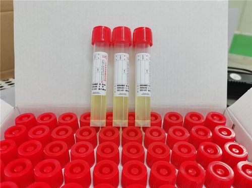 Labor-Probenahmeröhrchen - Cangzhou Yongkang Medical Devices Co., Ltd. - zylinderförmig / Nasen / Rachen