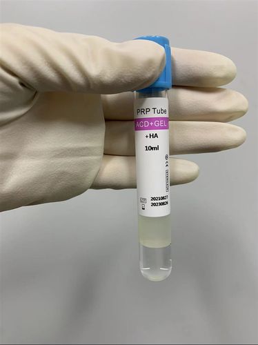 Probenahmeröhrchen für plättchenreiches Plasma - Cangzhou Yongkang Medical Devices Co., Ltd. - zylinderförmig / Blut / Plasma