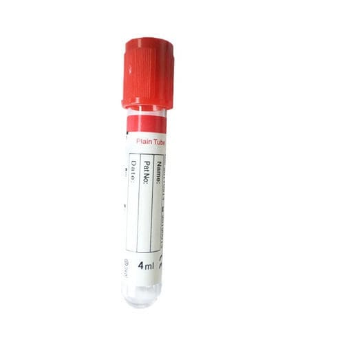 Probenahmeröhrchen für Diagnose - Cangzhou Yongkang Medical Devices Co., Ltd. - Immunoassay / zylinderförmig / Blut