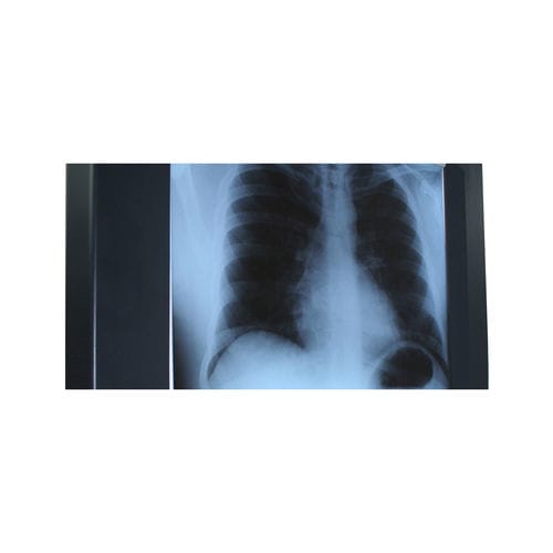 Röntgenfilmbetrachter / 1 Betrachtungsfläche - Woodmans Meditech - LED