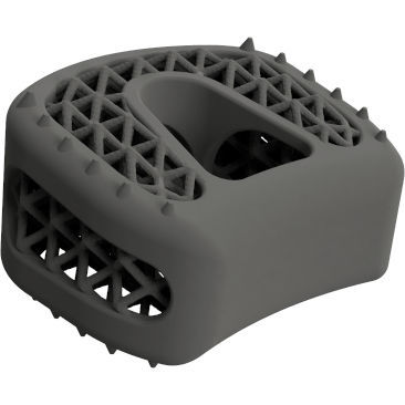 HWS-Zwischenwirbelimplantat - BMD ACIF GW ® - Global Biomedica - ventraler Zugang / Titan