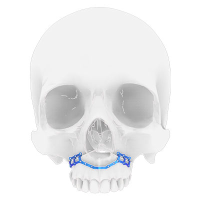 Osteotomieplatte für Oberkiefer - Osteophoenix - Titan