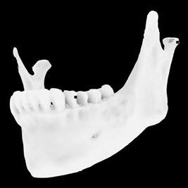 Anatomisches Modell / Knochen - Osteophoenix - Unterkiefer / für Zahnchirurgie