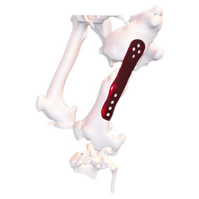 Veterinär-Knochen-Kompressionsplatte / Mehrzweck - Osteophoenix