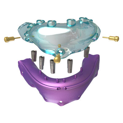 Chirurgische Schablone / für Dentalimplantologie - Osteophoenix