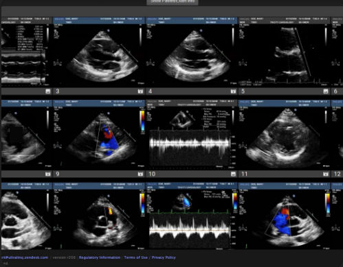 PACS für medizinische Bildgebung - Cardiology - UltraLinq