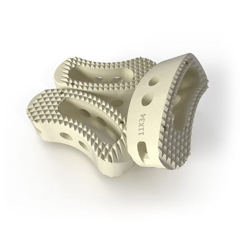 Thorako-lumbales Zwischenwirbelimplantat - 317 series TLIF - Wuxi Betta Medical Technology - transforaminaler Zugang / aus PEEK