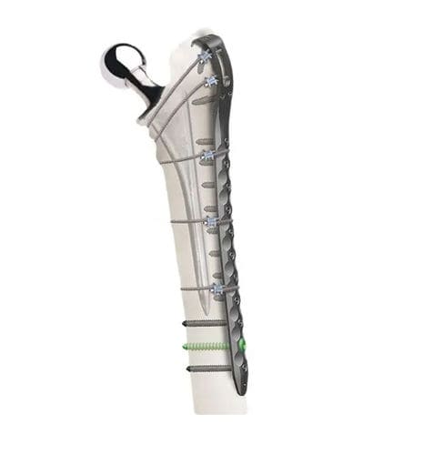 Kompressionsplatte für Acetabulum - Wuxi Betta Medical Technology - für periprothetische Femur-Fraktur / für Hüftkopf / Metall