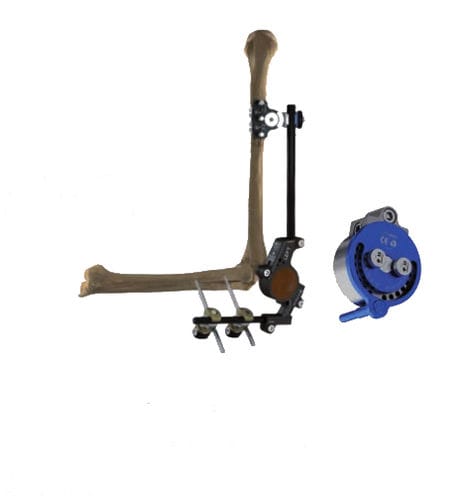 Fixateur externe / für Ellbogen - Wuxi Betta Medical Technology - hybrid / für Erwachsene / für Kinder