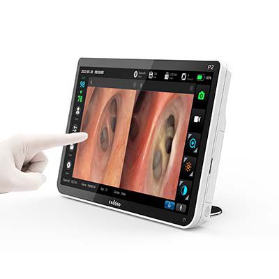 Videoprozessor für Endoskopie - P1 - Endoso Life Technology - mit USB-Anschluss / mit Videomonitor / mit Videorekorder