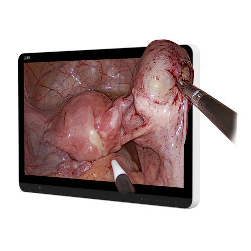 medizinisch Monitor - Hikimaging