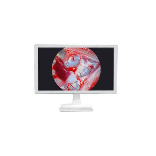 Medizinisch Monitor - TU-24M1080P - Shenzhen Tuyou Medical Imaging Co., Ltd.​ - für OP-Bereich / OP / 27"