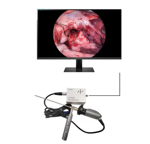 Endoskop-Kamera - TU-Y2HC - Shenzhen Tuyou Medical Imaging Co., Ltd.​ - medizinisch / digital / Full HD