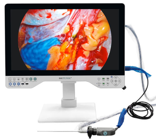 Medizinische Kamera - TU-15LSD1B - Shenzhen Tuyou Medical Imaging Co., Ltd.​ - OP / digital / Full HD